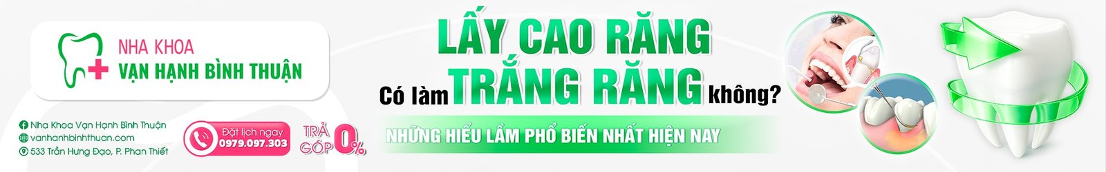 Lấy cao răng có làm trắng răng không? Những hiểu lầm phổ biến nhất hiện nay
